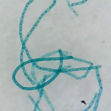 Slides-Spirogyra w.m.