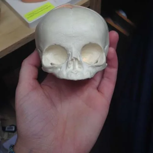 Anatomy-Fetal Human Skull