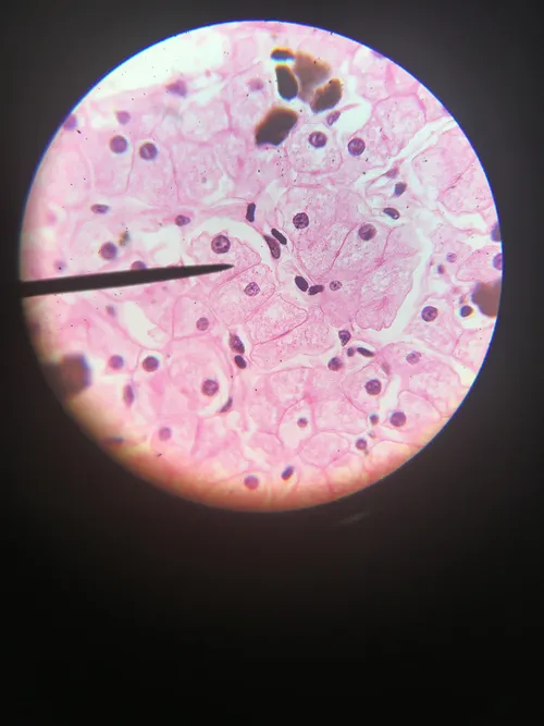 Slides-Amphiuma liver section