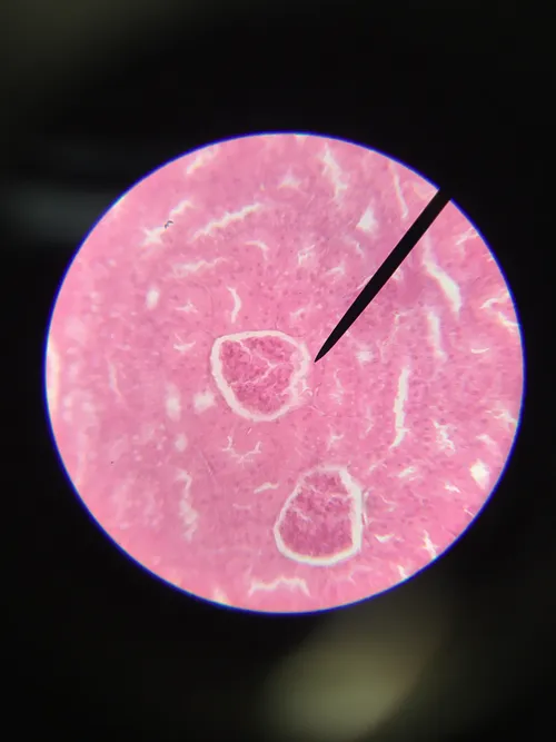 Slides: Kidney near-median, l.s.
