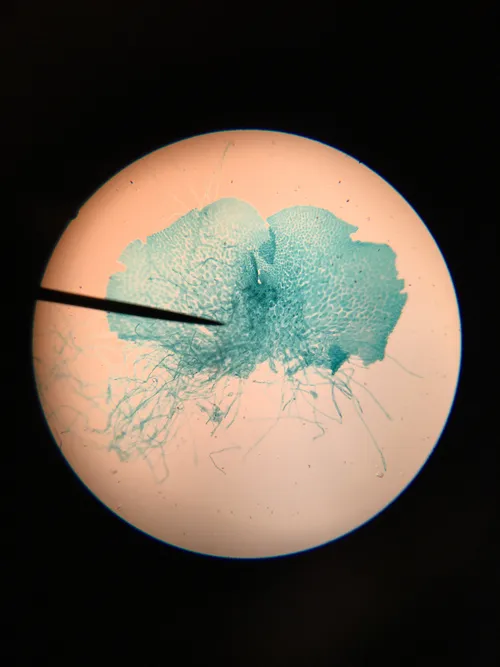 Slides: Fern Archegonia, w.m.