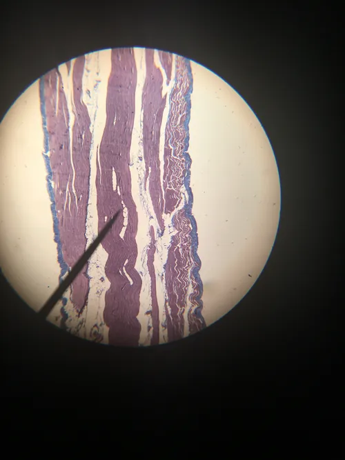 Slides-Muscle types (smooth, striated, & cardiac) sec.