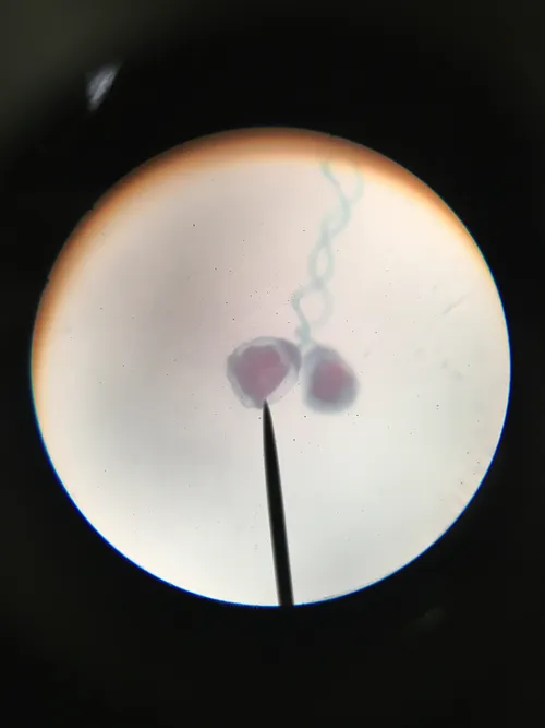 Slides-Vorticella w.m.