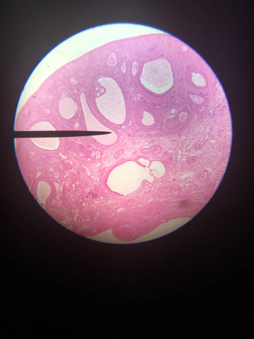 Slides: Mammal Ovarian Follicles sec.