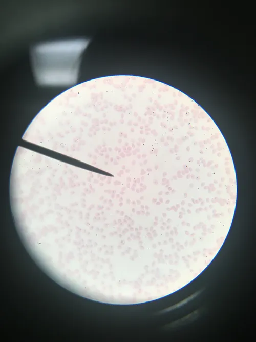 Slides: Fish Blood Film Smear