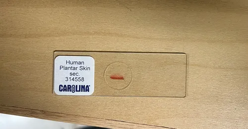 Slides-Human Plantar Skin 