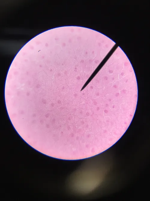 Slides-Mitosis, fish blastodisc sec.