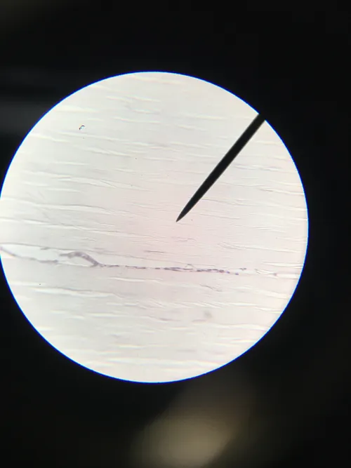 Slides-Elastic Tissue yellow (ligamentum nuchae), l.s.