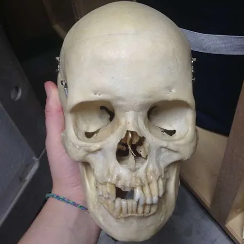 Anatomy-Human Skull (real)