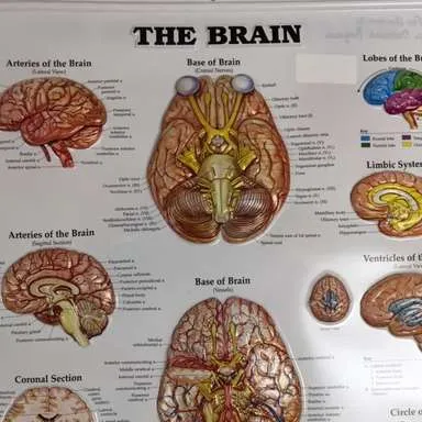 Posters-Brain (3D)