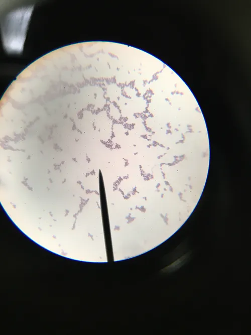 Slides: Saccharomyces (yeast) Budding Cells