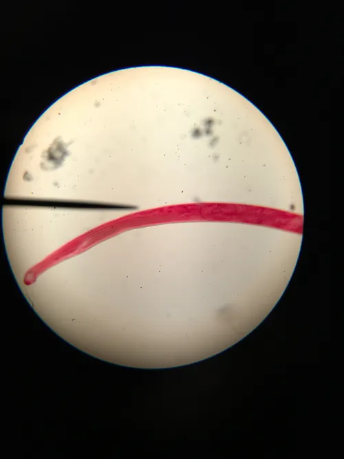 Slides-Ancylostoma caninum female (hookworm), w.m.