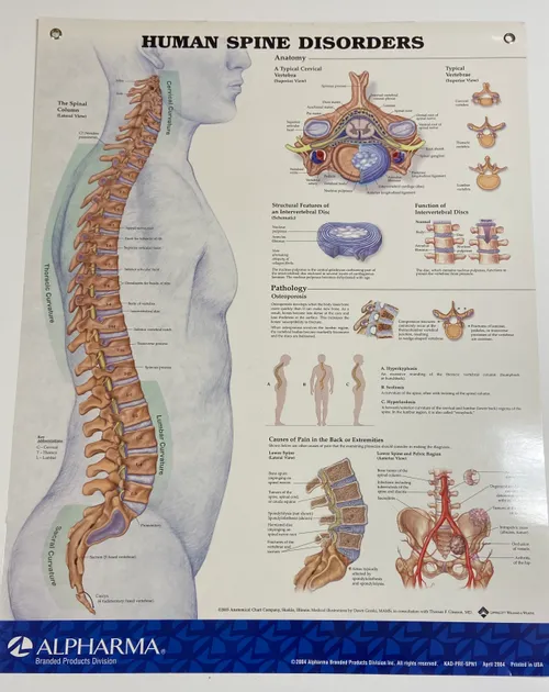 Poster: Human Spine Disorders