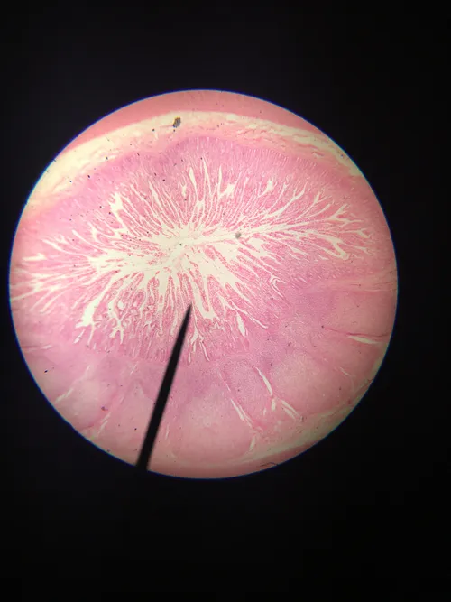 Slides: Peyer's Patches (lymphatic tissue)