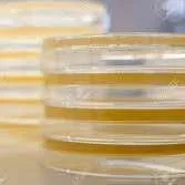 Microbiology: Agar Plates (TSA, nutrient, general purpose)