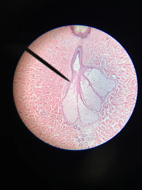 Slides: Human skin, thin, pigmented