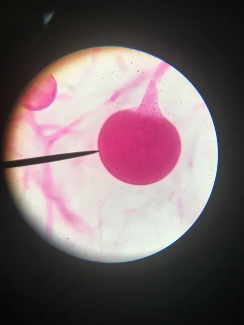 Slides: Rhizopus Sporangia, w.m.