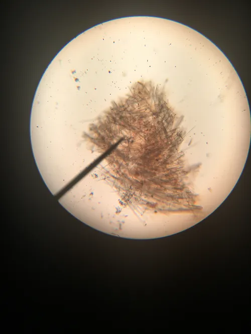 Slides: Freshwater Sponge