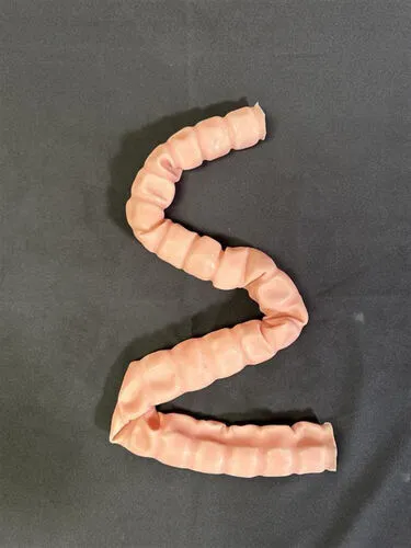 VP SET - COLON MODEL (BOWEL)