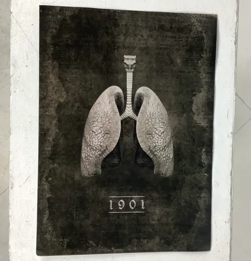 Black and Grey 1901 Lung Poster