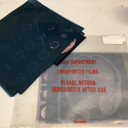 Plastic wallet with x ray sheets/pictures