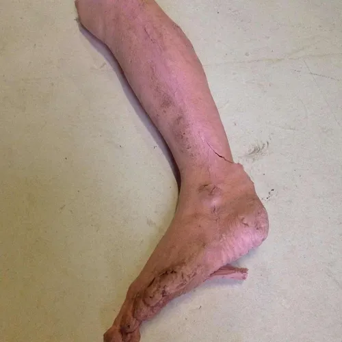 Severed Limb Prosthetic Lower Leg
